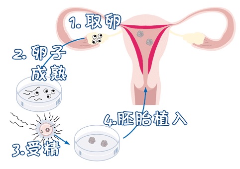 私人志愿者代孕服务怎么选